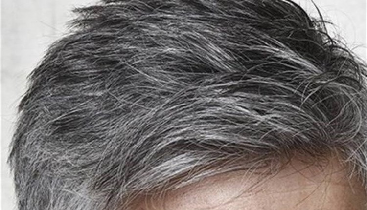 شناسایی ارتباط سفیدشدن موها و فعالیت سیستم ایمنی بدن