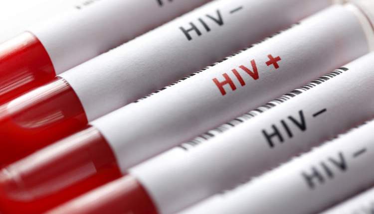 یک آزمایش امیدبخش برای مقابله با ویروس ایدز