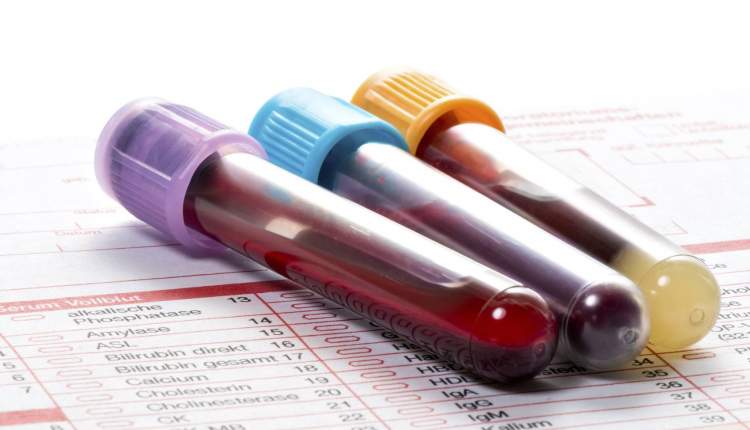 تبلیغ و انجام نمونه‌گیری برای آزمایش‌های تشخیصی کروناویروس ممنوع است