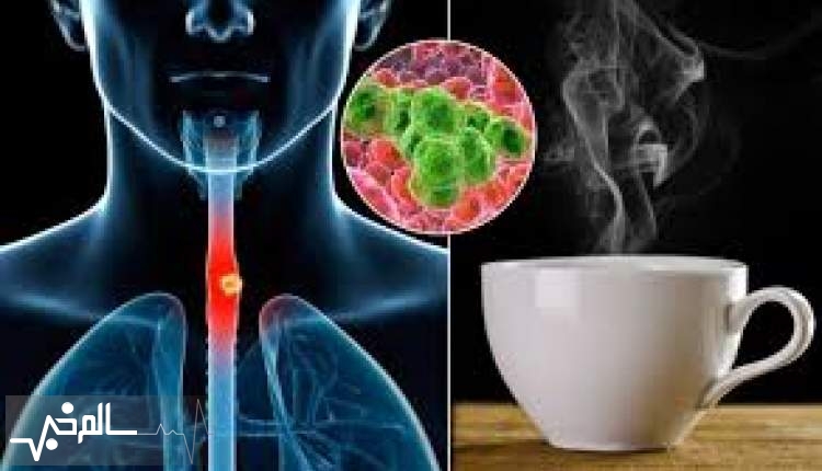 ابتلای سالانه 10 هزار بریتانیایی به سرطان مری به دلیل چای داغ
